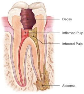 dental2